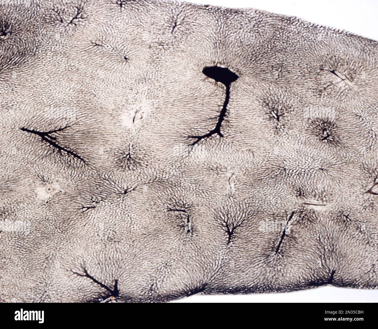 The study of an organ microvasculature usually implies the filling of