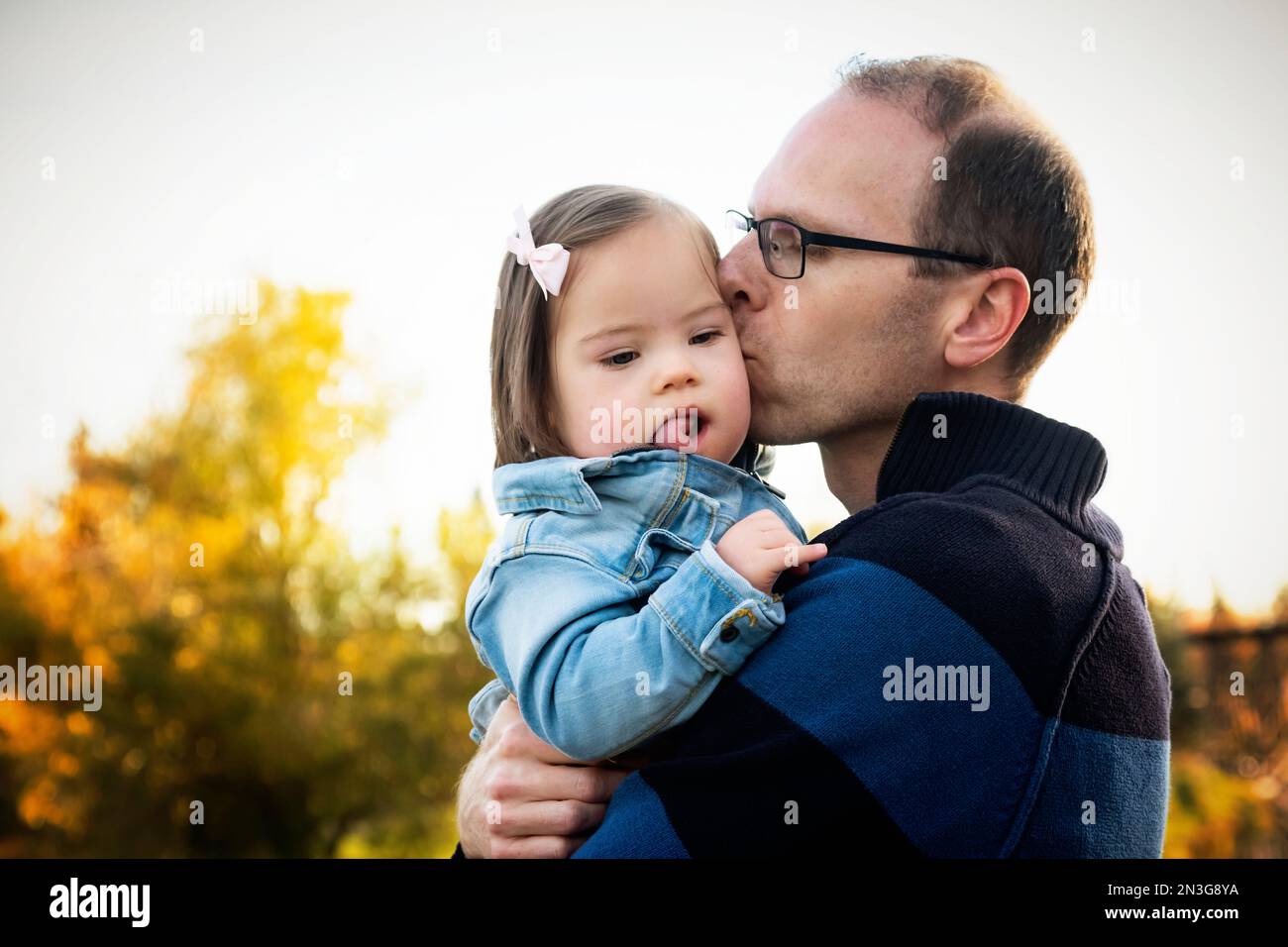 Father holds and kisses his baby daughter who has Down Syndrome in a park during the fall season; St. Albert, Alberta, Canada Stock Photo