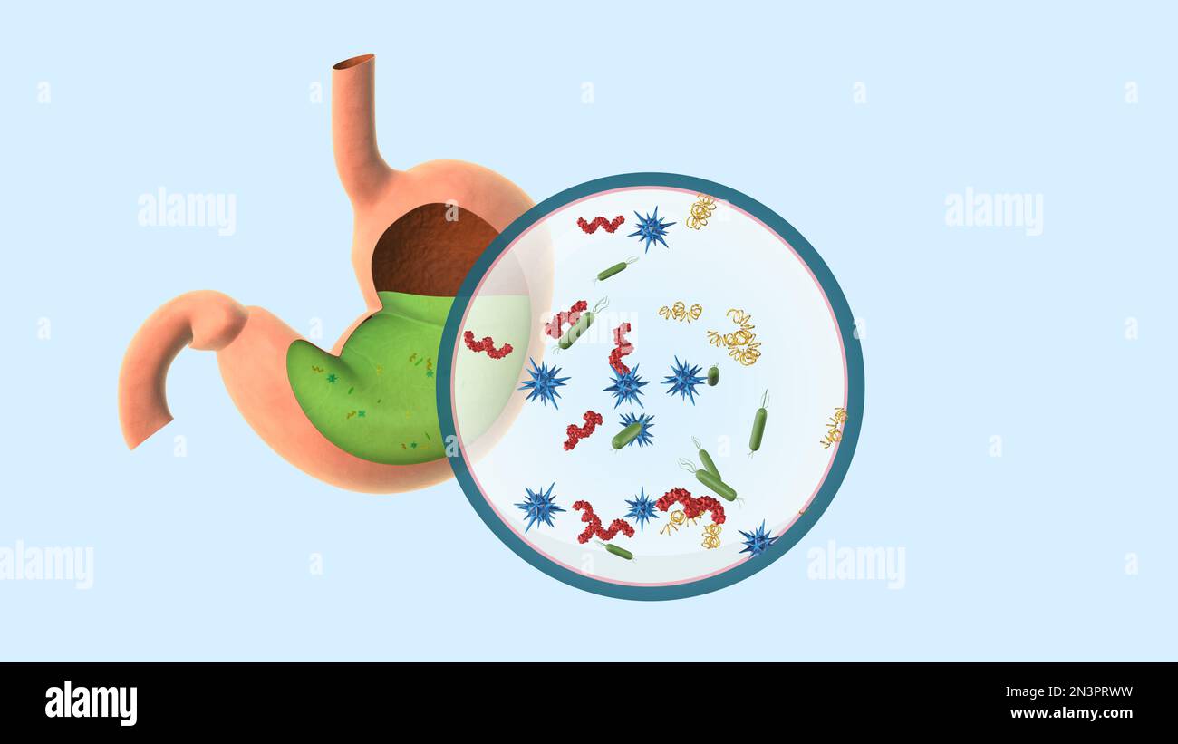 Germs In Stomach Cause To Stomachache And Food Poisoning Stock Photo