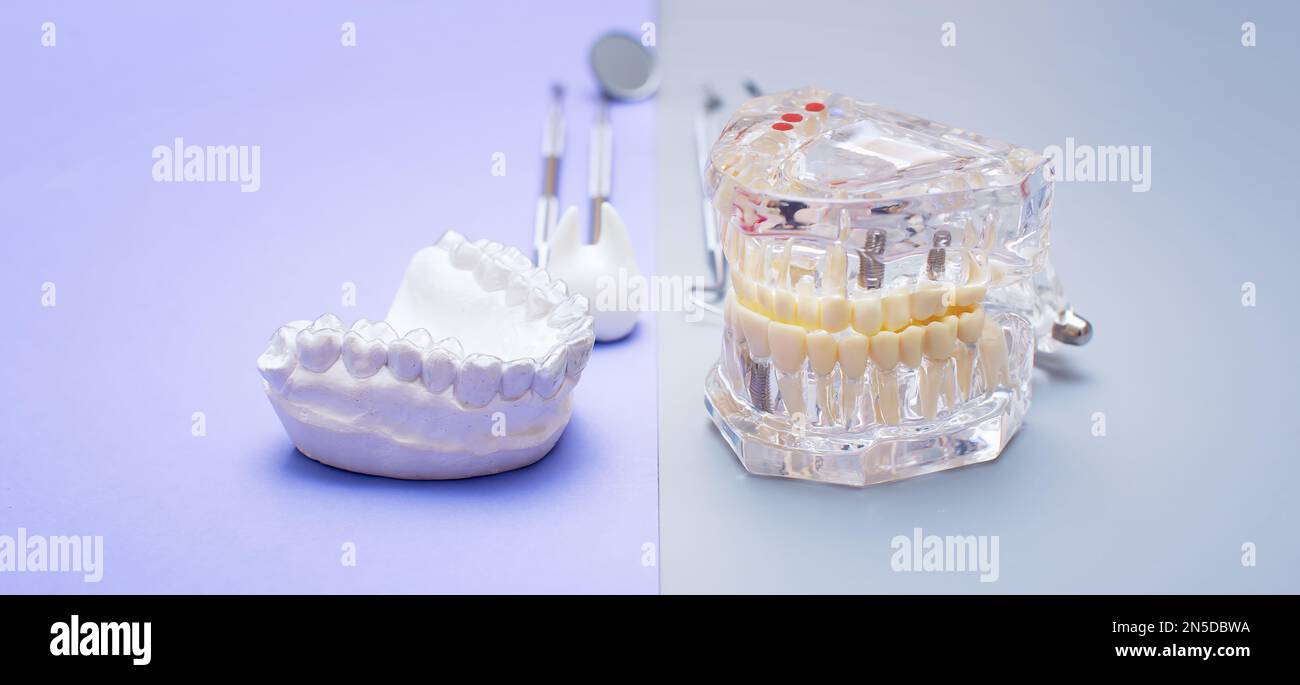 Dental tools and model of teeth on a blue background. Dental care ...
