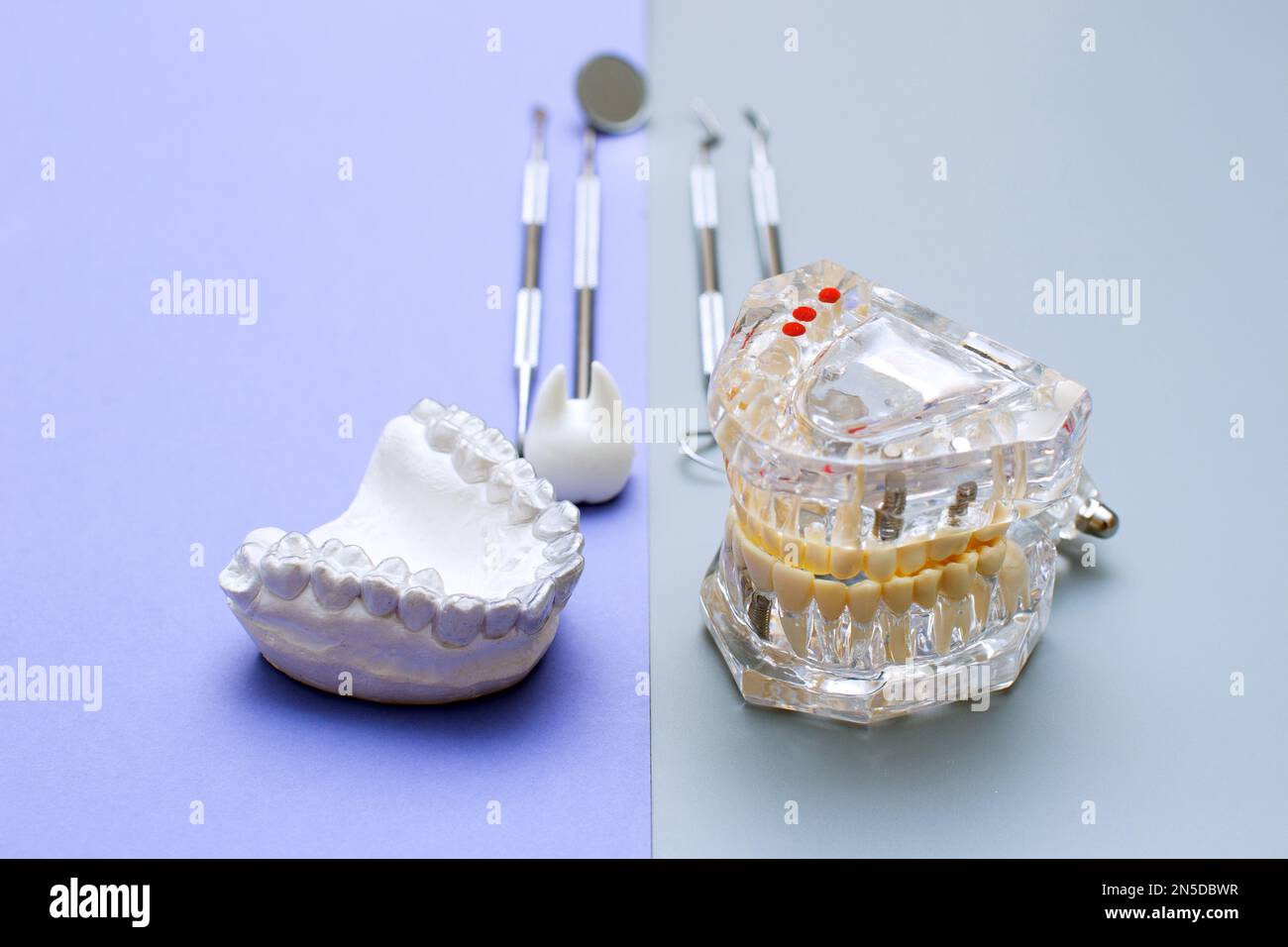 Dental tools and model of teeth on a blue background. Dental care ...
