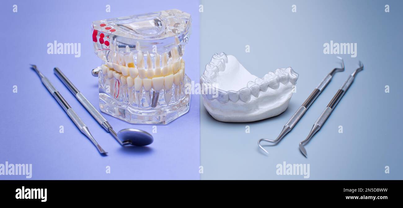 Dental tools and model of teeth on a blue background. Dental care ...