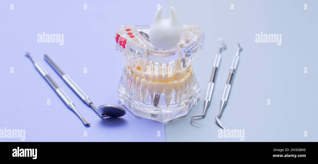 Dental tools and model of teeth on a blue background. Dental care ...