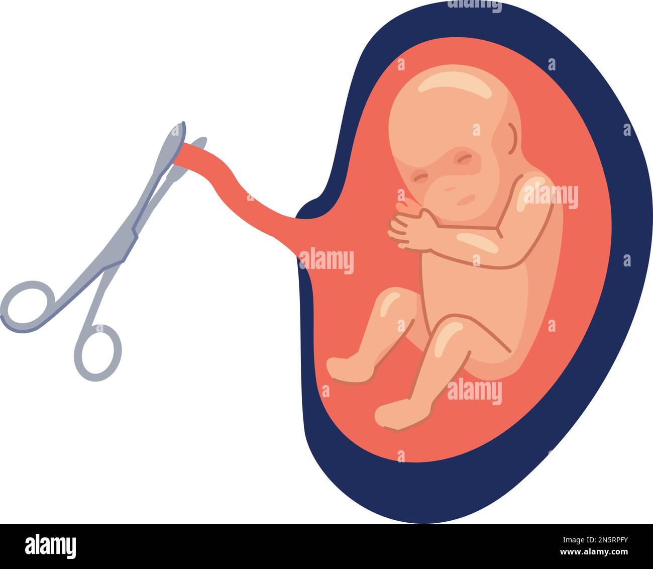 Cutting The Umbilical Cord Stock Image C0530817 Scien vrogue.co
