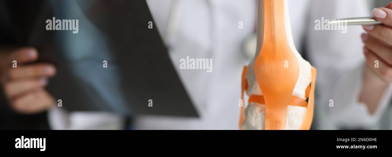 Doctor shows anatomy of knee joint and x-ray Stock Photo - Alamy
