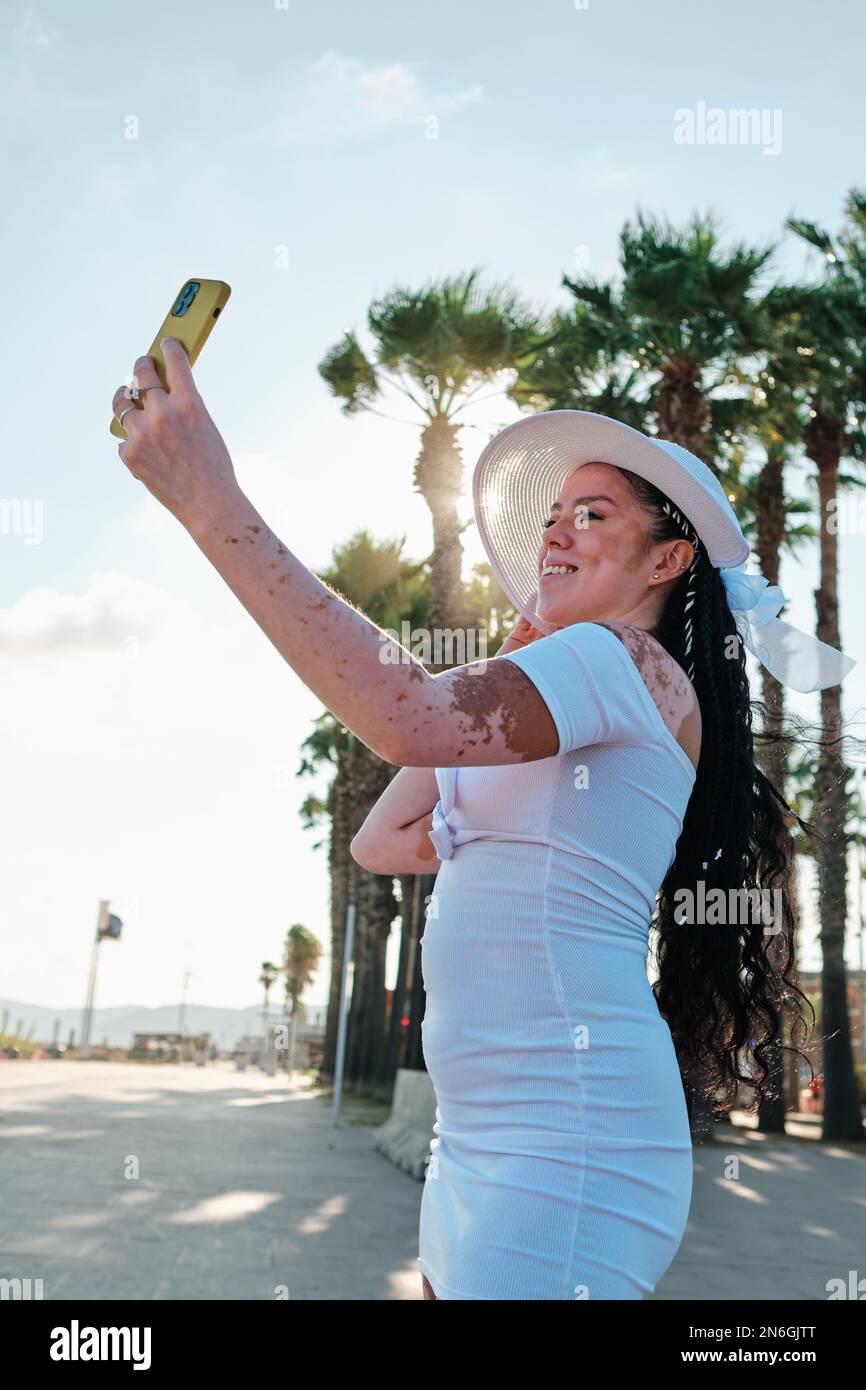 Woman with vitiligo taking selfies with a mobile phone standing outdoors near palm trees. Stock Photo