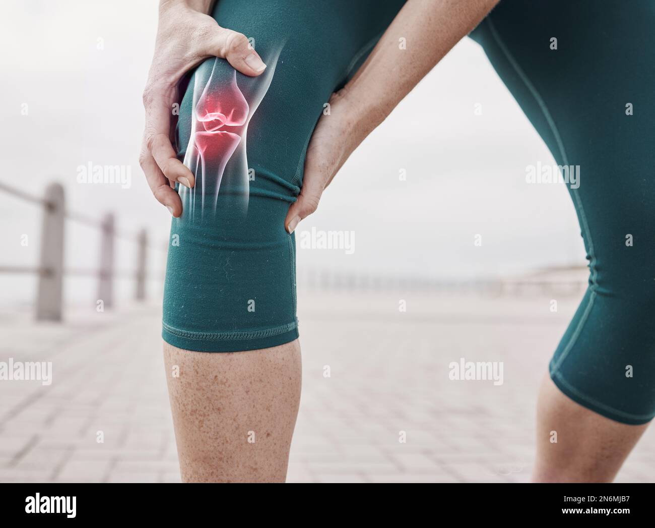 Closeup of knee injury, woman holding leg or skeleton of exercise and anatomy of joint inflammation. Person exercising, physical pain in muscle and Stock Photo