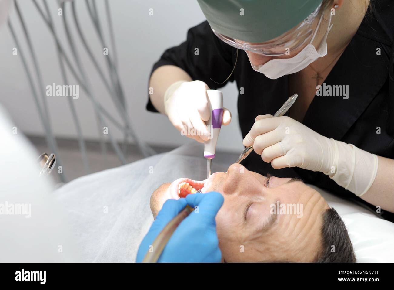 hard tooth extraction, tooth extraction tools Gracie curette, piezo