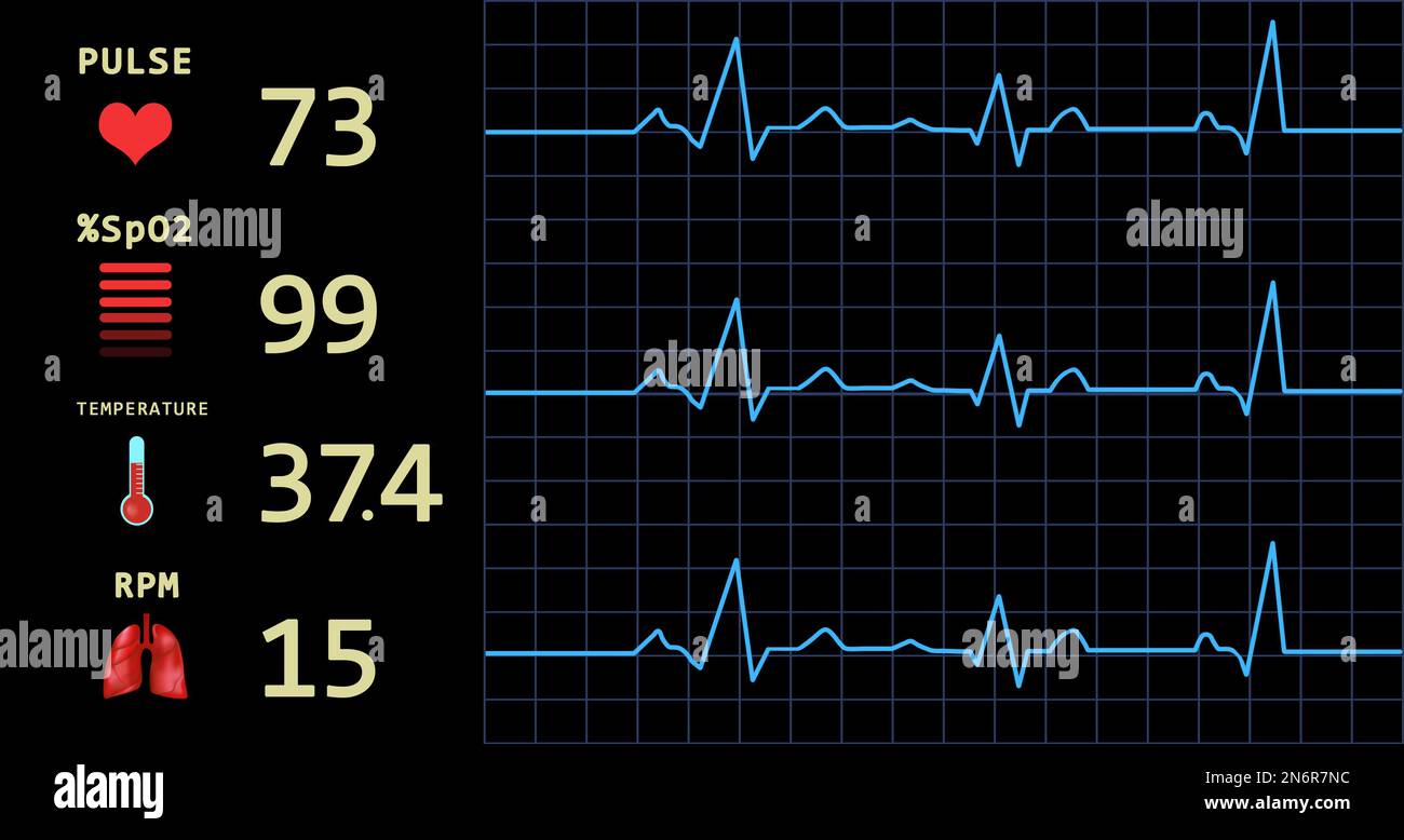 Cardiogram and data on display of heart rate monitor. Illustration