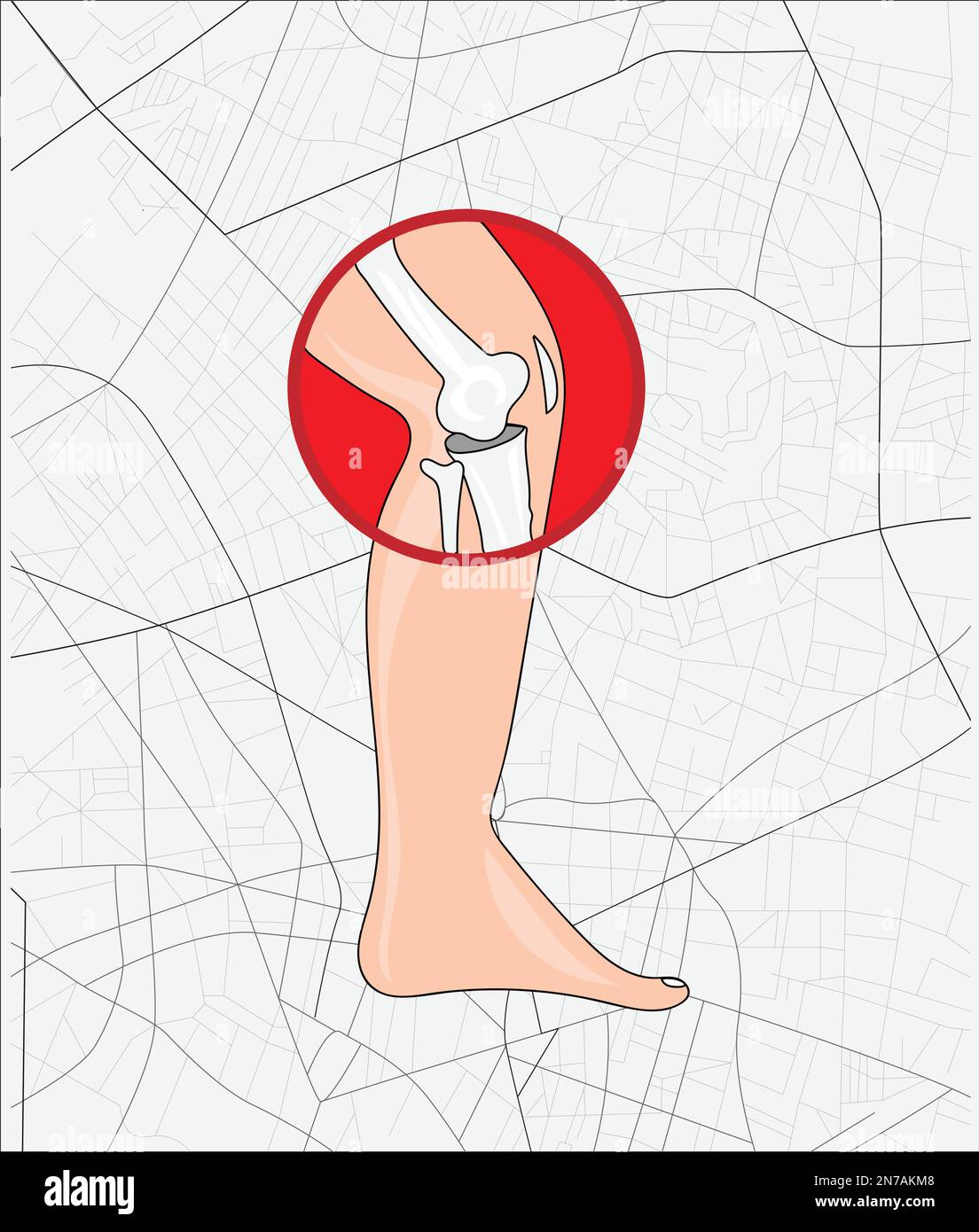 leg joint pain treatment vector poster illustration Stock Vector Image