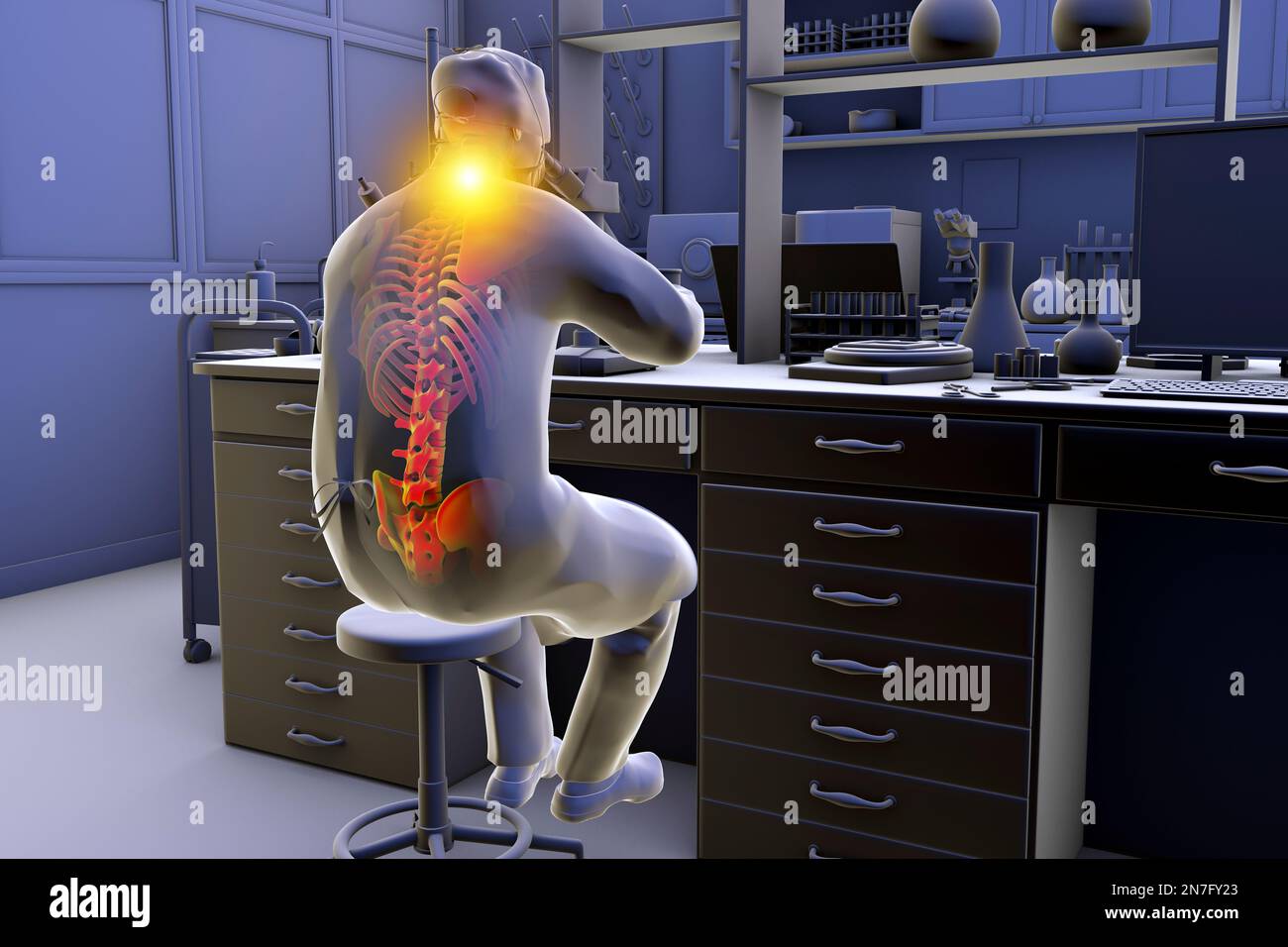 Musculoskeletal disorders in lab workers, illustration Stock Photo Alamy