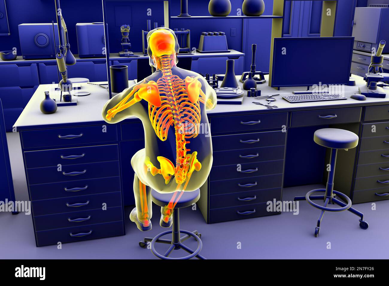 Musculoskeletal disorders in lab workers, illustration Stock Photo Alamy