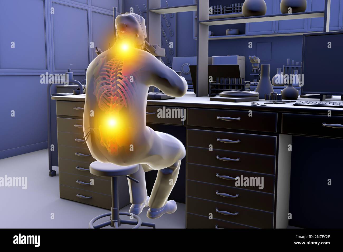 Musculoskeletal disorders in lab workers, illustration Stock Photo