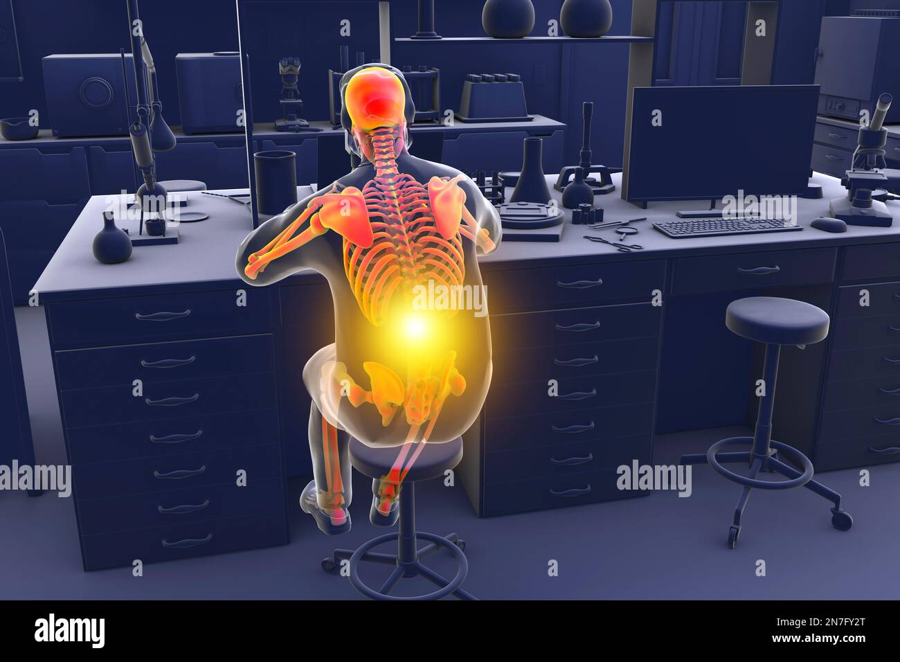 Musculoskeletal disorders in lab workers, illustration Stock Photo Alamy