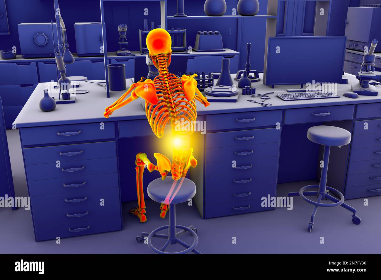 Musculoskeletal disorders in lab workers, illustration Stock Photo Alamy