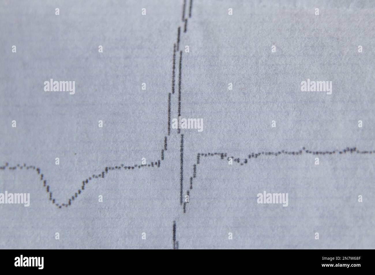 cardiogram on old paper as background macro photo Stock Photo