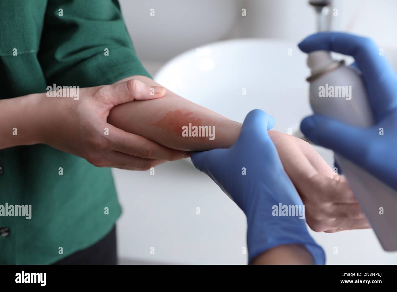 Applying burn spray onto injured skin, closeup Stock Photo Alamy