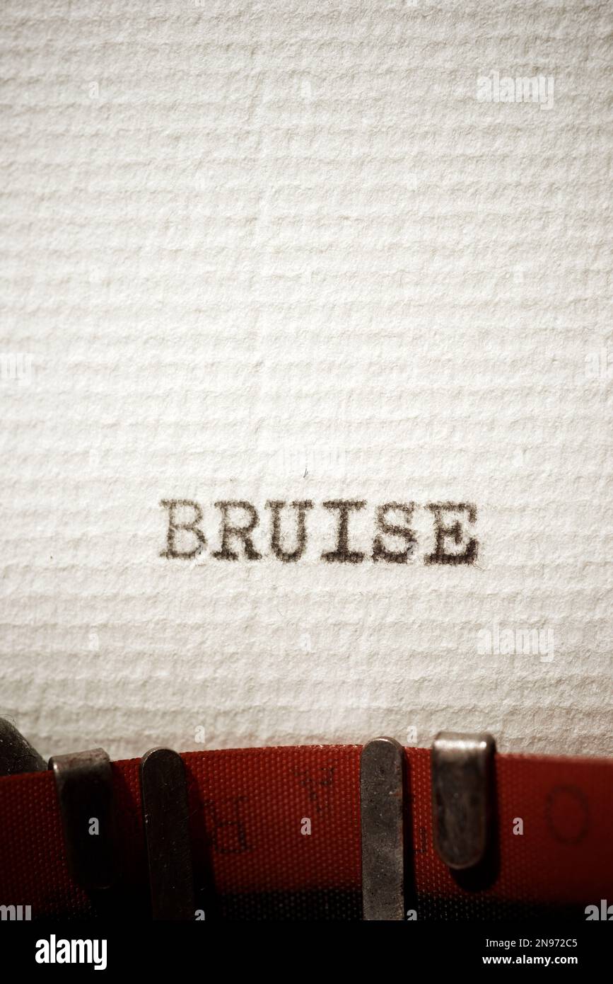 Bruise word written with a typewriter Stock Photo Alamy
