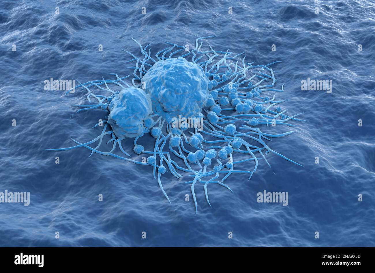 Thyroid cancer cells isometric view 3d illustration Stock Photo Alamy