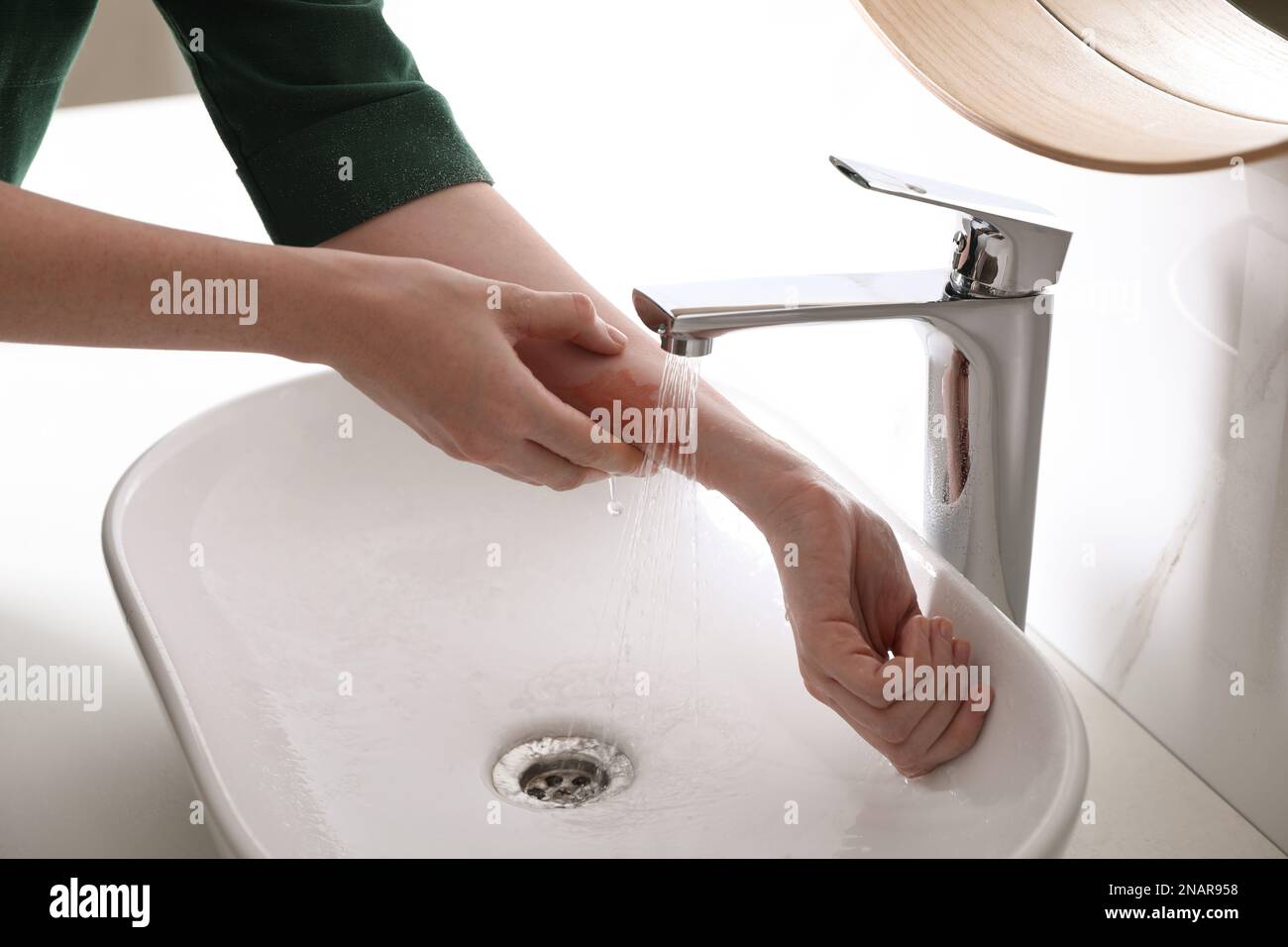 Woman putting burned hand under running cold water indoors, closeup