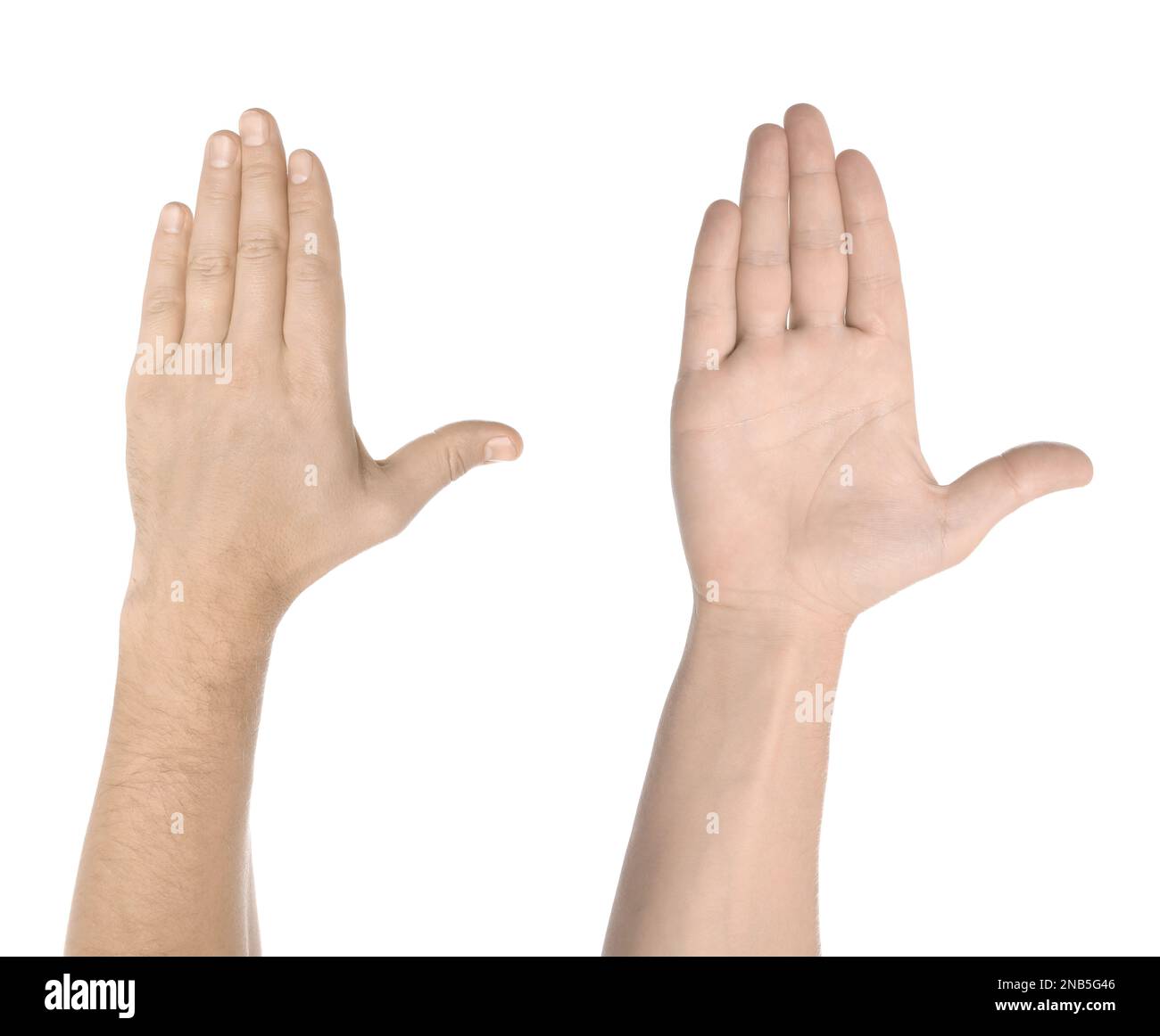 Man showing pale hand on white background, closeup. Anemia symptom