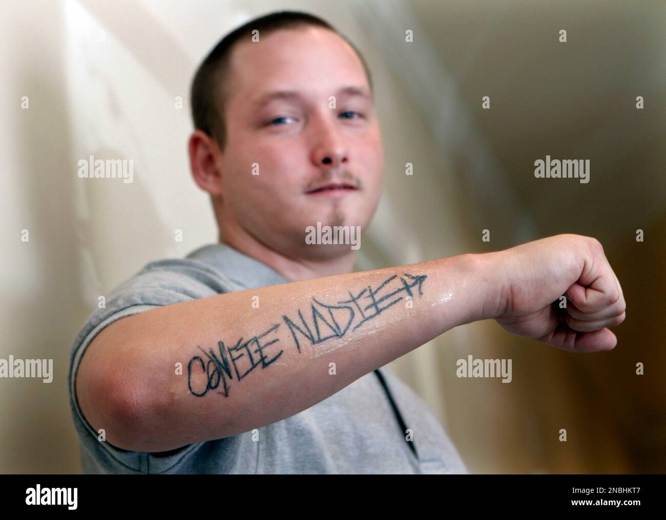 Adrienne Ashtari left a nurse at the Skin Center in Pittsburgh uses a  laser in the first treatment on Wednesday July 6 2011 to remove a tattoo  from Christopher Guajardo 24 to