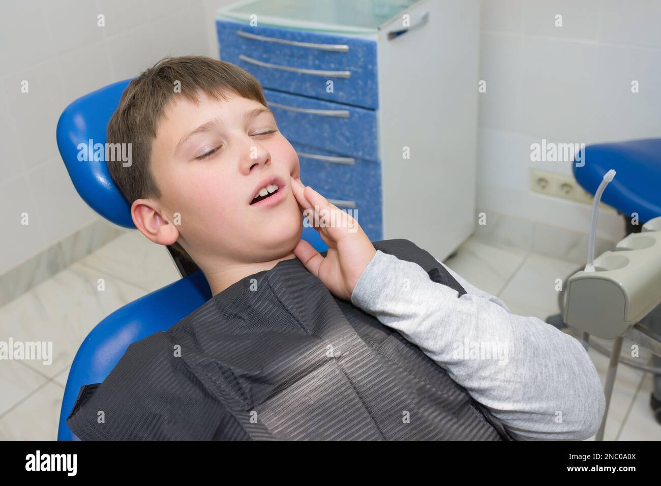 A boy with a swollen jaw after a professional pulling out a tooth Stock