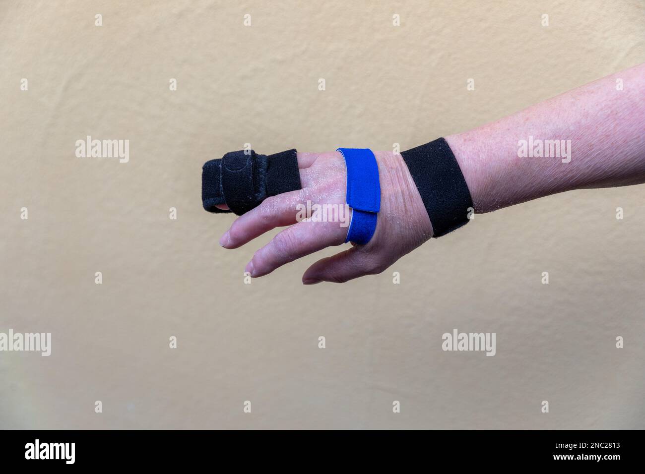two sided finger splint with two hook and loop straps on a broken