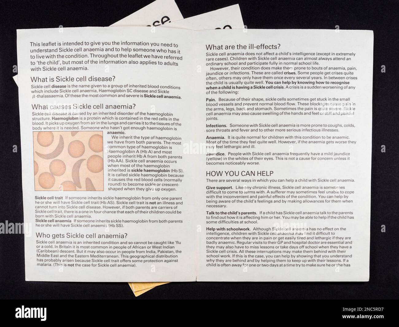 Sickle cell disease hi-res stock photography and images - Alamy