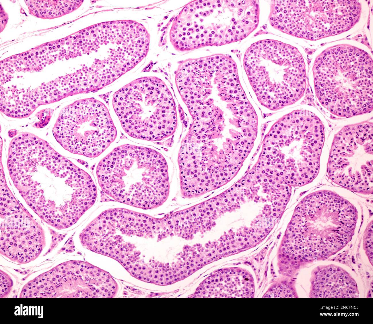 Human seminiferous tubules, light micrograph Stock Photo - Alamy