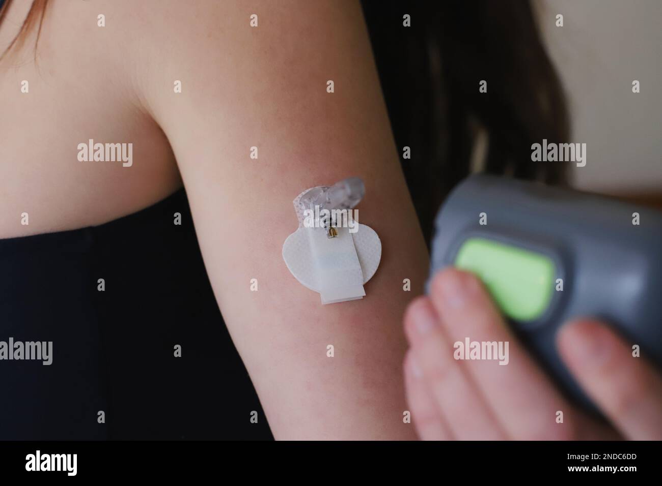 Amazon.com: 30 Pack Adhesive Patches Pre-Cut for Dexcom G7 Stelo CGM ...