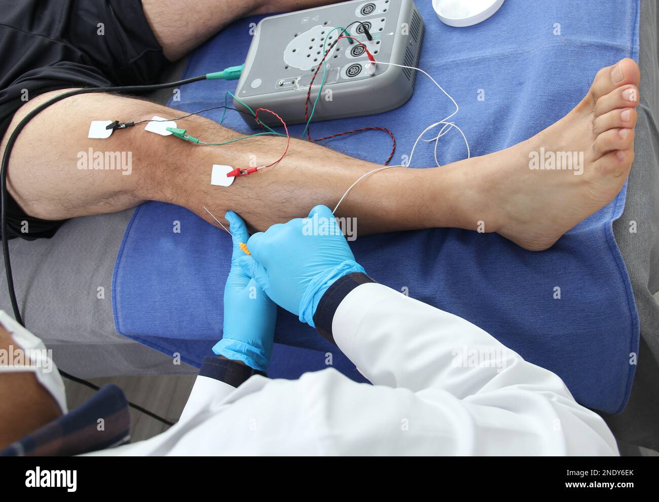 Electromyography in the lower limbs, graphic recording technique of the