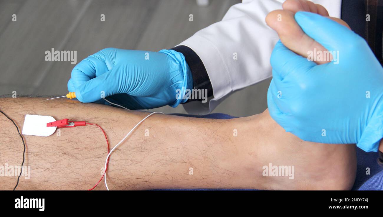 Electromyography in the lower limbs, graphic recording technique of the electrical activity produced by the tibial muscle performed by a specialist ne Stock Photo