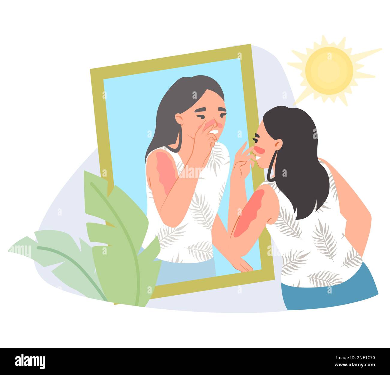 Young woman touching sunburned nose flat vector Stock Vector