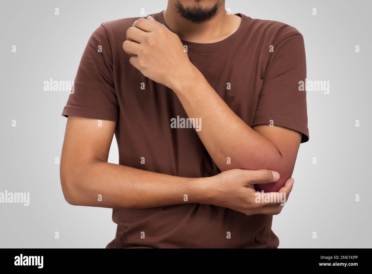 The man's elbow swollen redness because accident Stock Photo Alamy