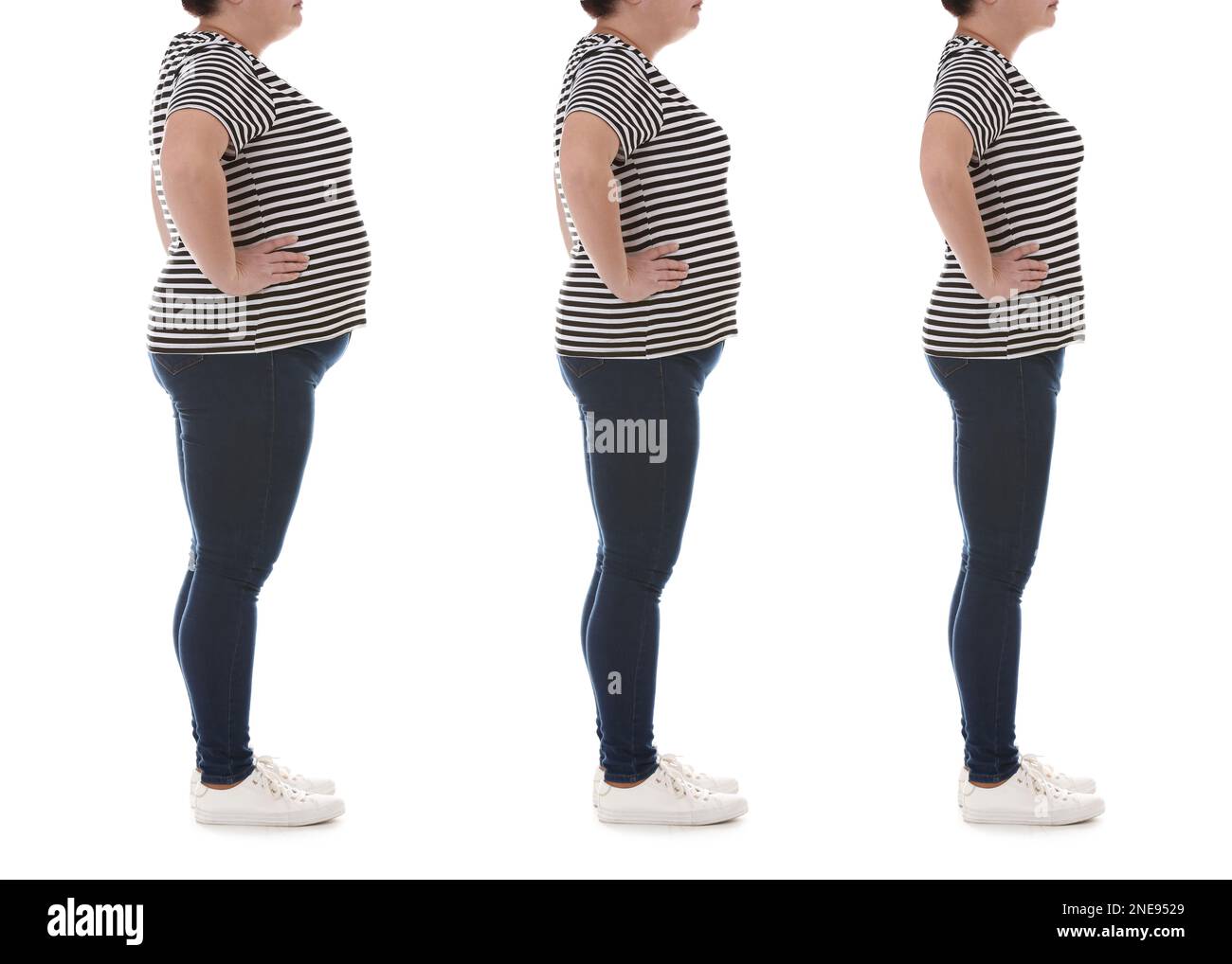 Woman before and after weight loss on white background, collage Stock Photo