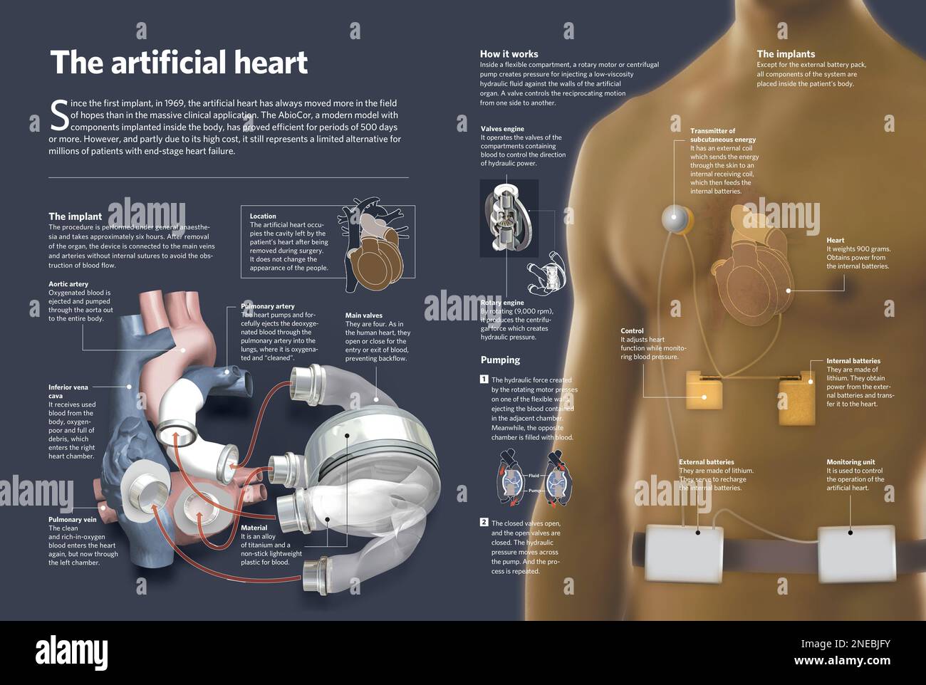 Infographic that approaches us to the world of artificial hearts, an