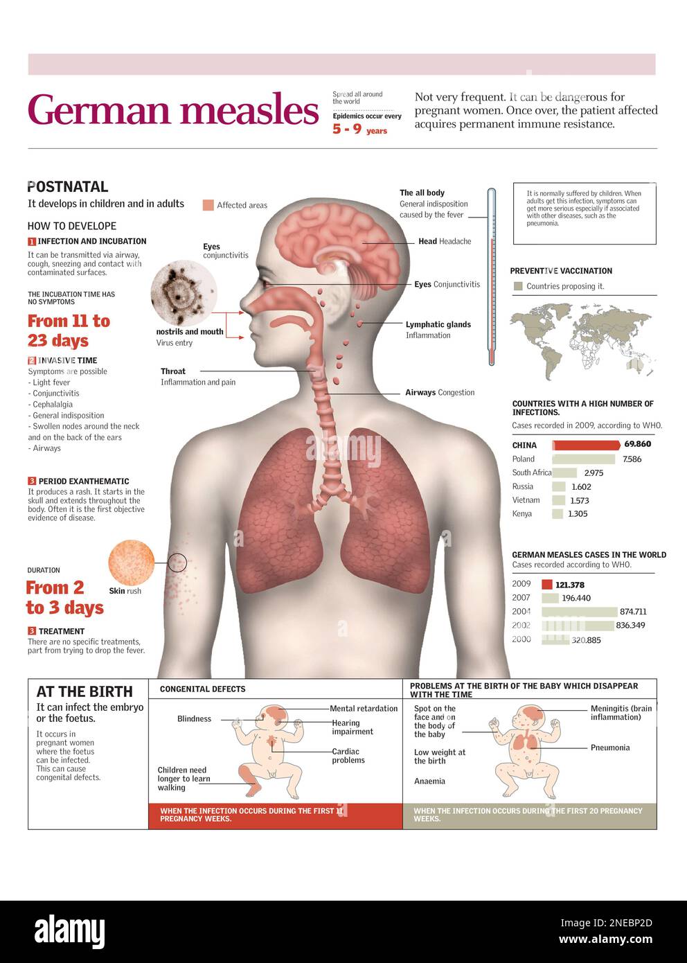 Rubella Infectivity Infographics of the ways of transmission, infection, symptoms, effects ...