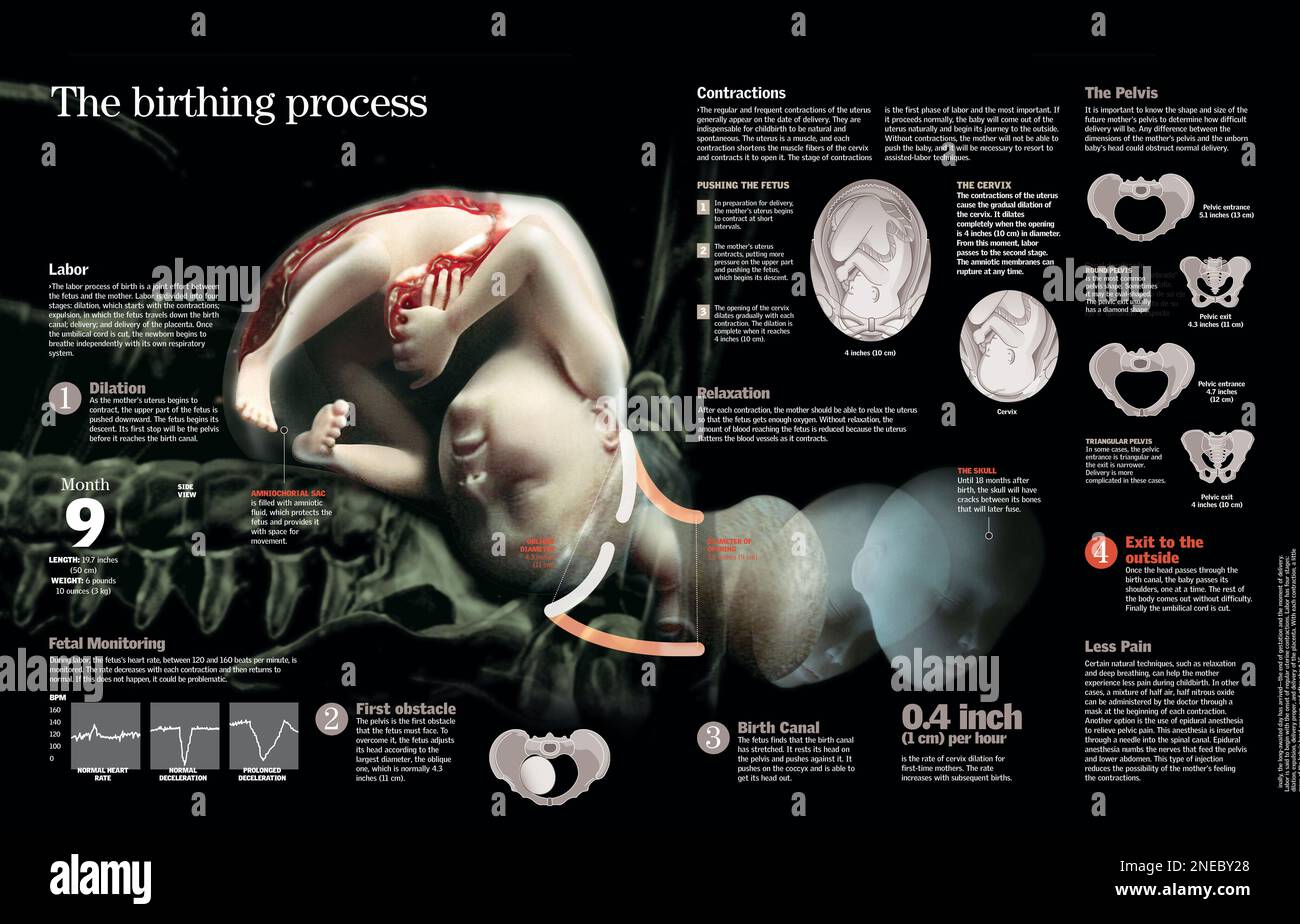 Infographic describing the process of childbirth, its phases, possible ...