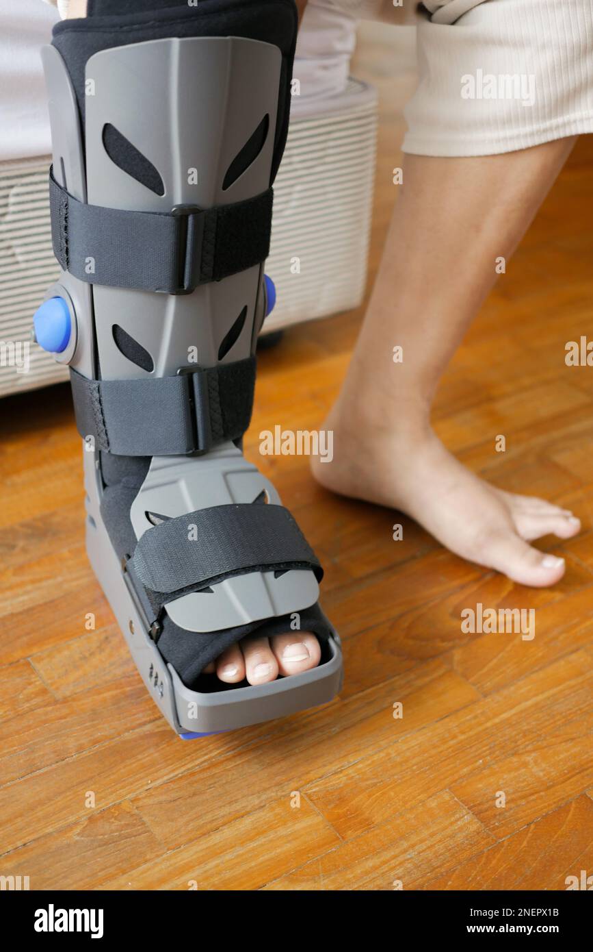 women broken feet with a grey plastic boot ankle brace injury protecting boot Stock Photo Alamy
