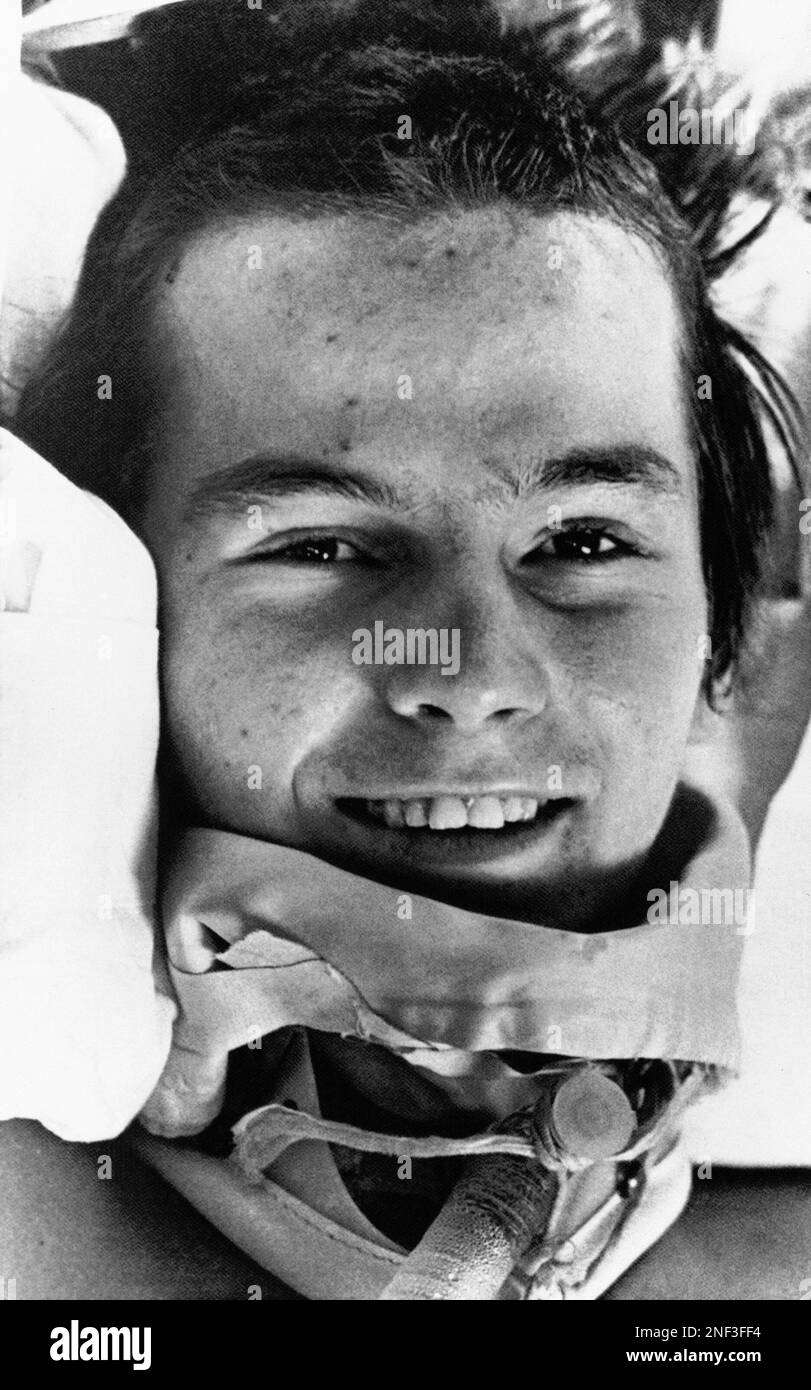Pat Bickle, 17 of Kansas City, Mo., manages smile, Nov. 16, 1973