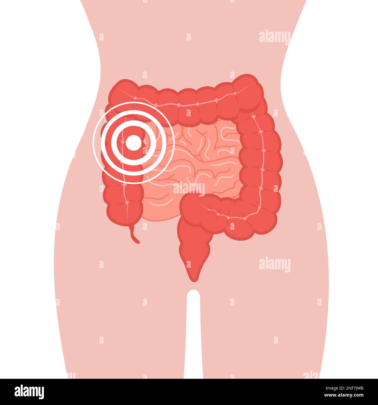 Pain in intestines. Colon diseases. Cancer of internal organs. Medical ...