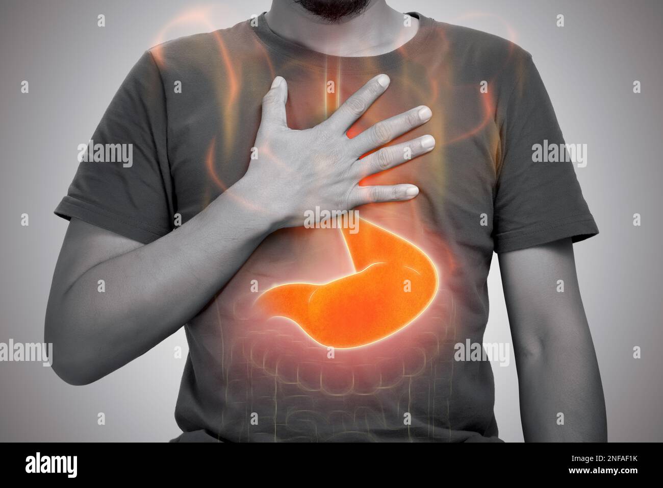 A man burning sensation in chest from acid reflux on gray background. Stock Photo