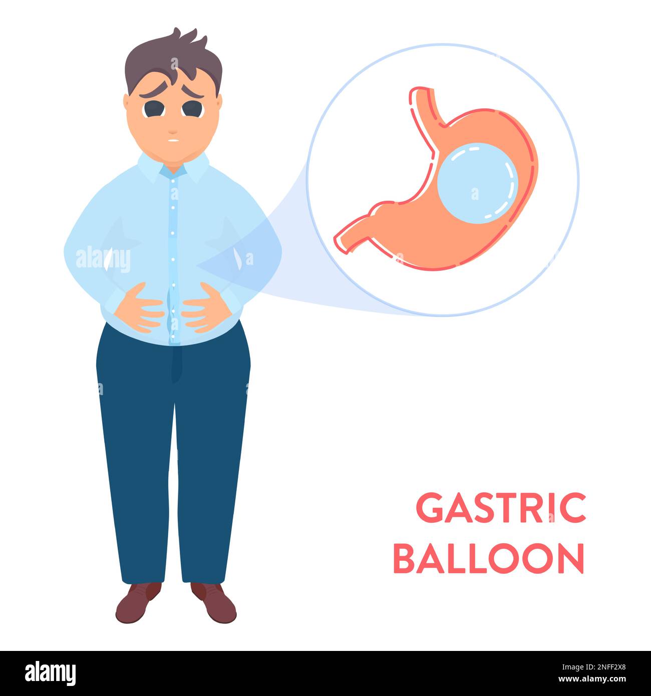 Gastric balloon weight loss procedure shown in stomach of a man Stock Vector Image & Art Alamy
