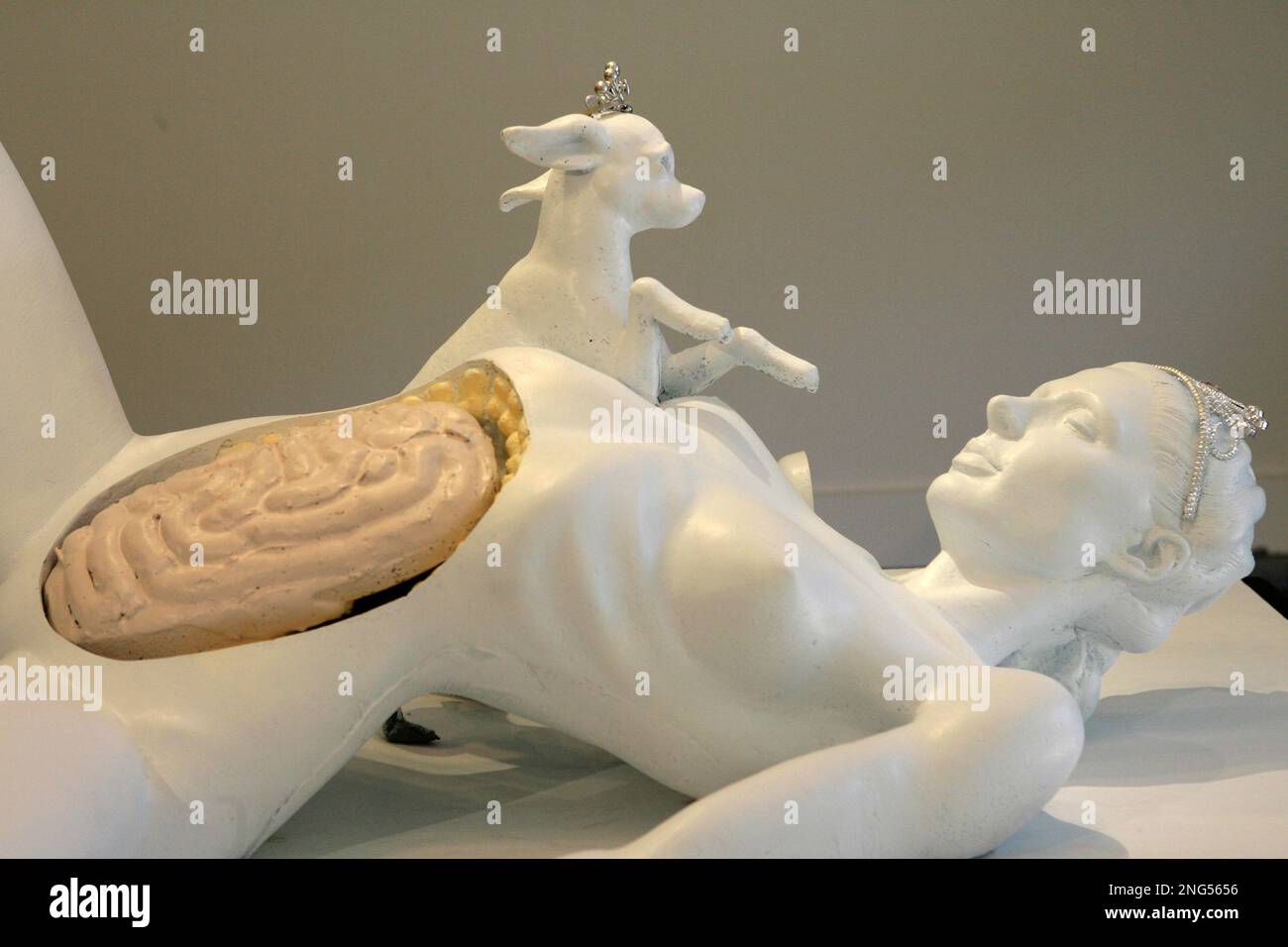 Daniel Edwards' "Paris Hilton Autopsy" is on display during the press preview at the Capla Kesting Fine Art gallery Wednesday, May 9, 2007 in New York. The sculpture will be on exhibit to the public May 11 through May 30 at the gallery in the Williamsburg neighborhood of Brooklyn . (AP Photo/Mary Altaffer) Stock Photo
