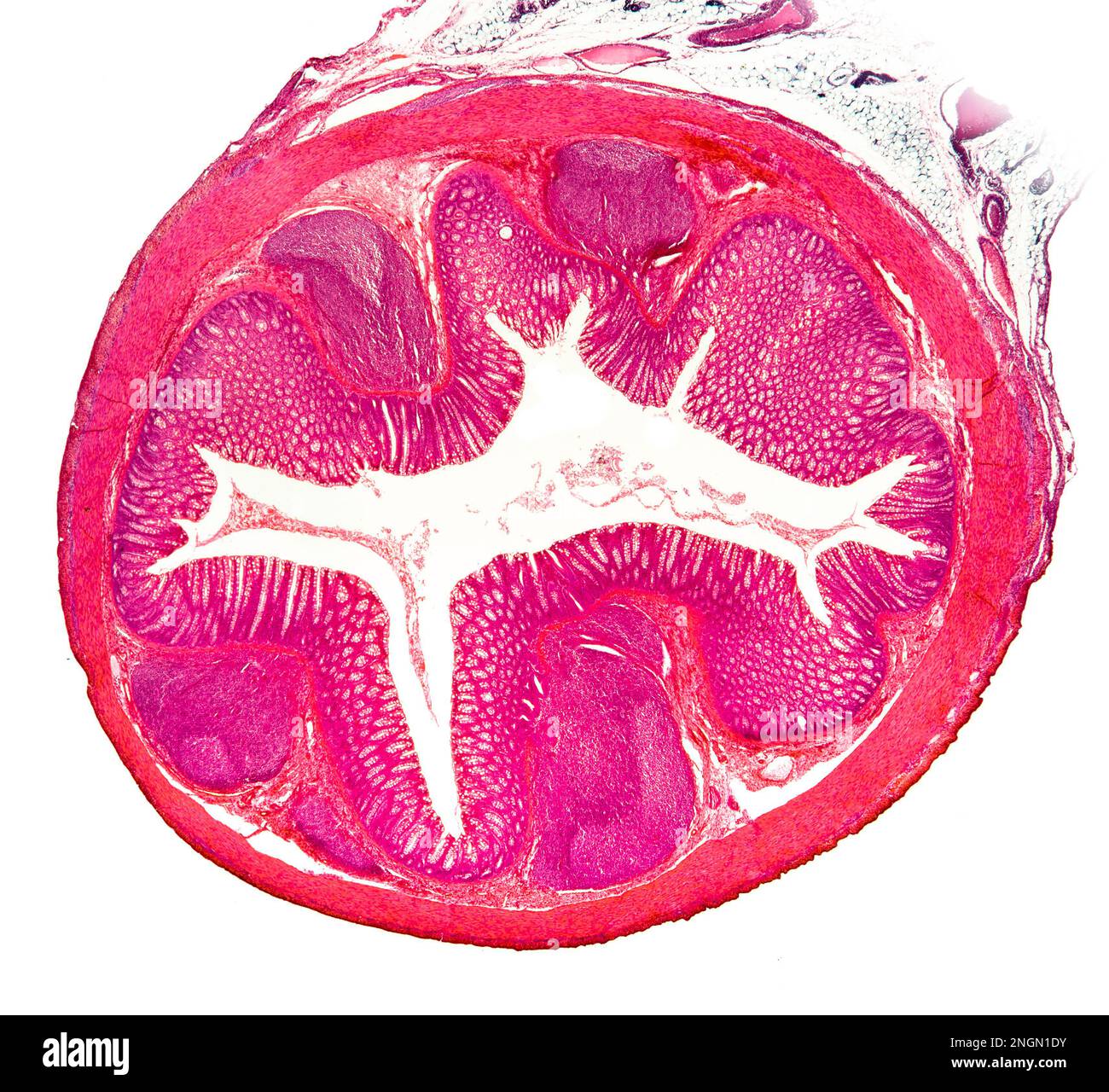 The cecum or caecum is a pouch within the peritoneum that is considered