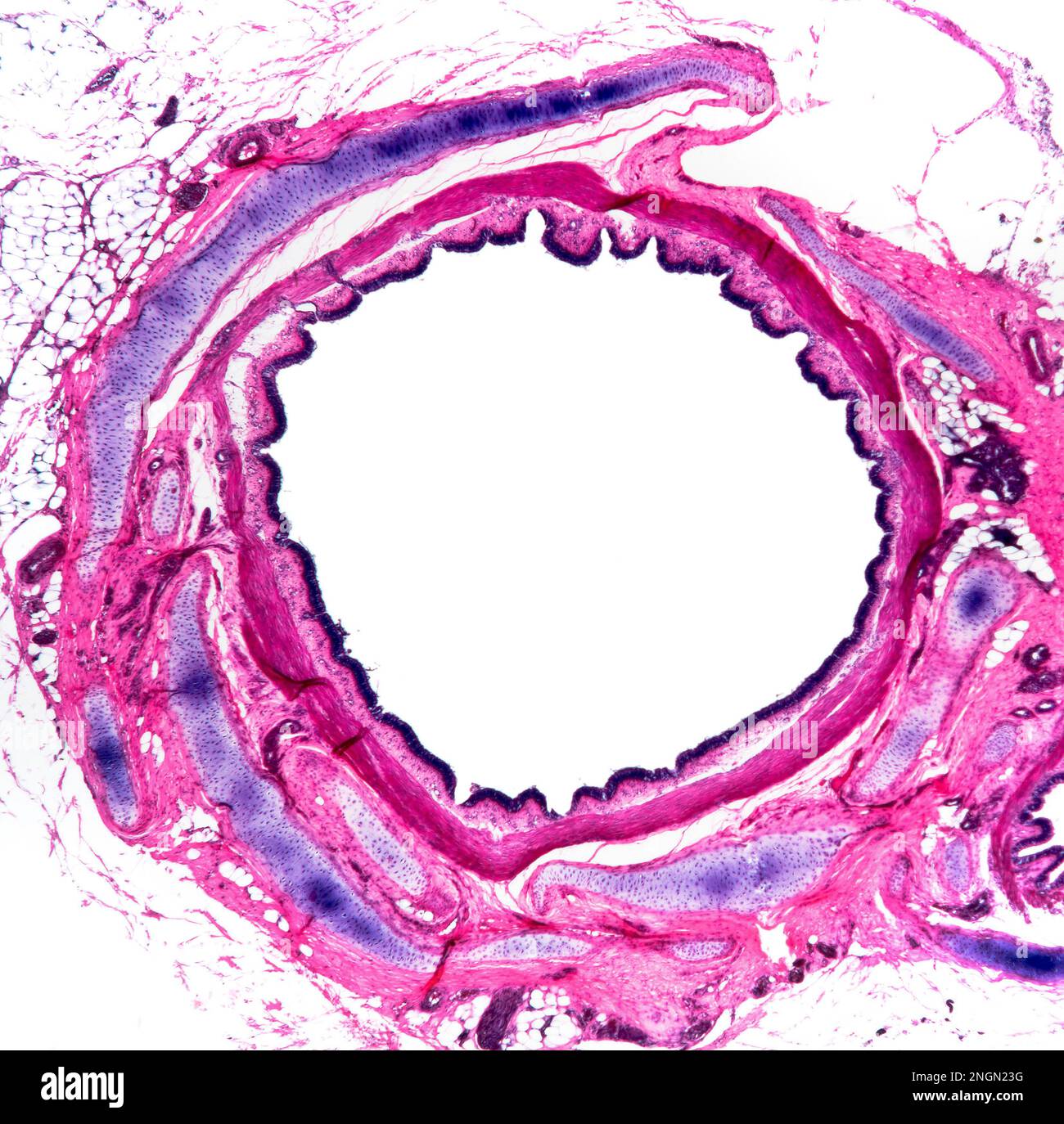 Human brochal section, bronchi are the airways that lead from the