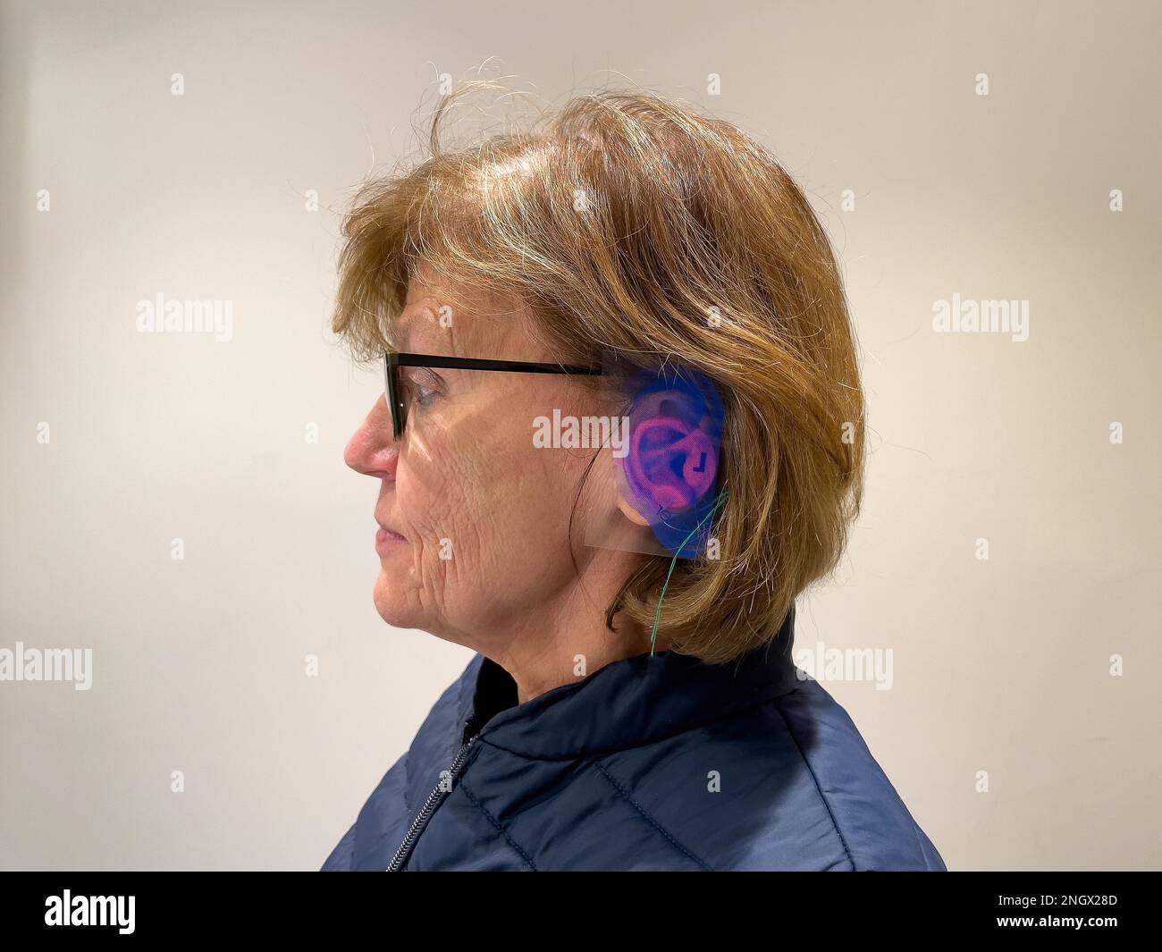 Moulded ear mould Otoplasty in colour blue for left ear Hearing aids