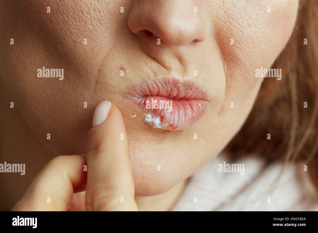 Closeup on middle aged woman with herpes on lips applying ointment using finger isolated on beige background. Stock Photo