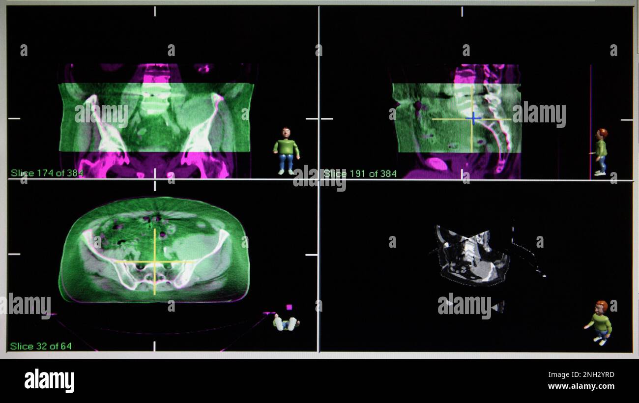 Beam field imaging hi-res stock photography and images - Alamy